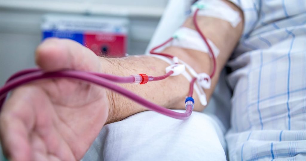 Hemodiálise: conheça os principais insumos químicos